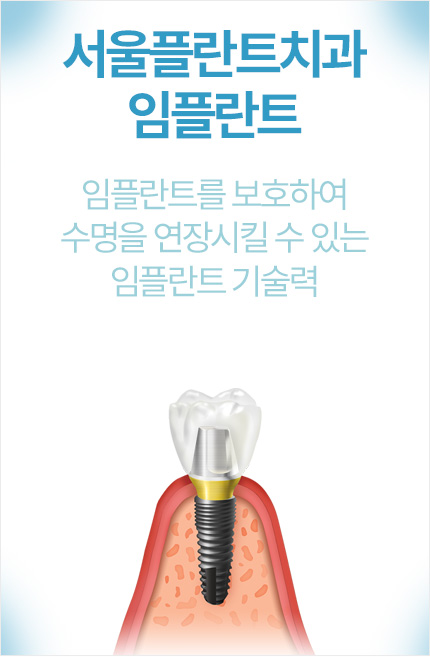 �����ö�Ʈġ�� ���ö�Ʈ