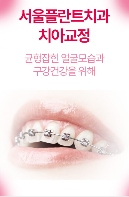 �����ö�Ʈġ�� ġ�Ʊ���