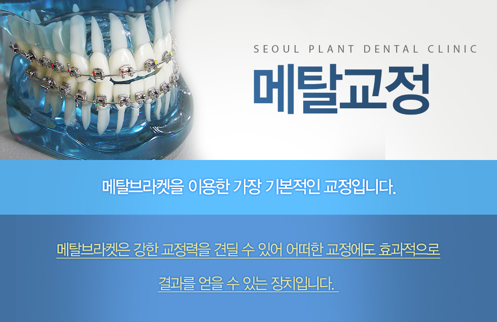 ��Ż����