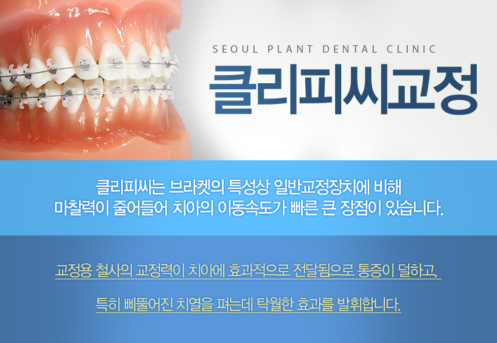 Ŭ���Ǿ� ����