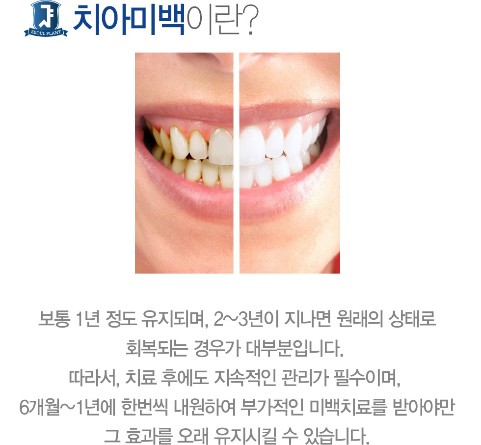 ġ�ƹ̹��̶�