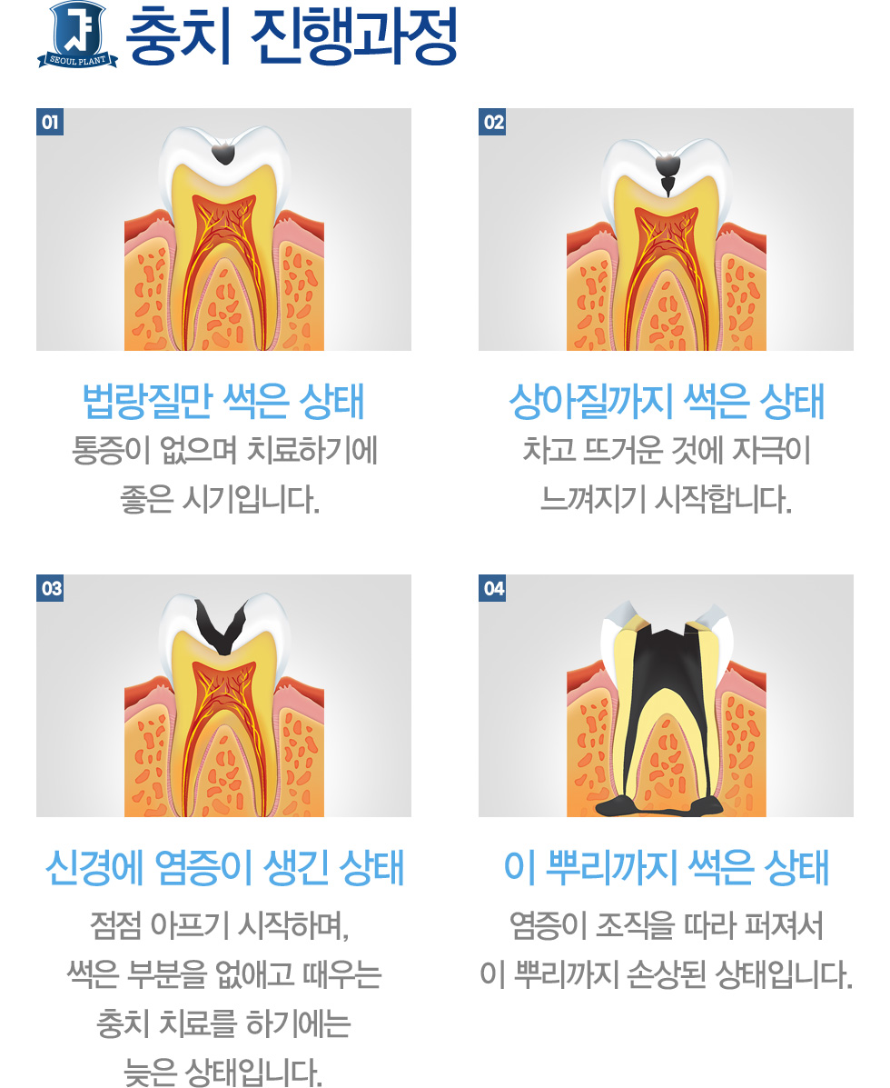 ��ġ �������