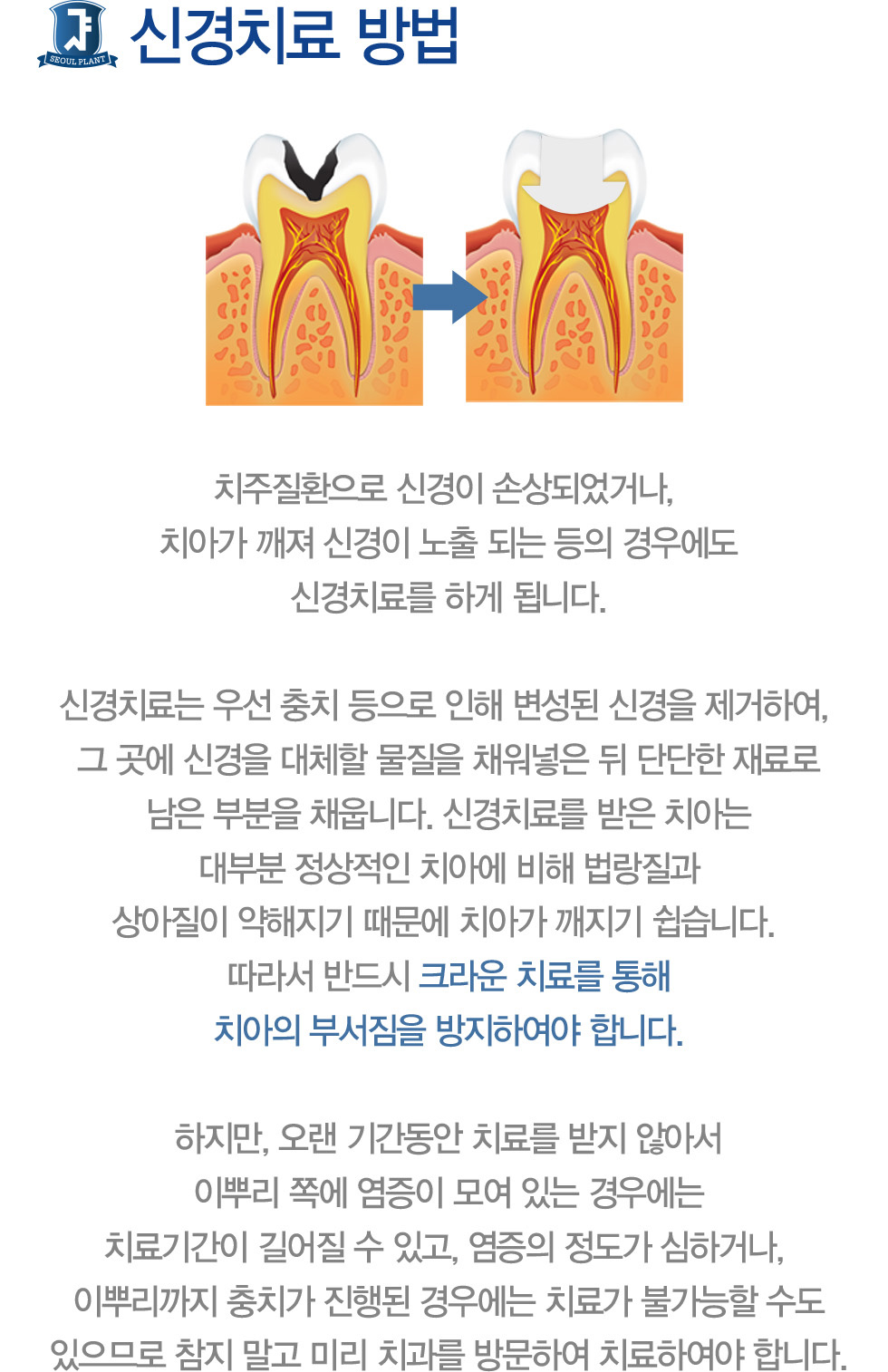 �Ű�ġ�� ���